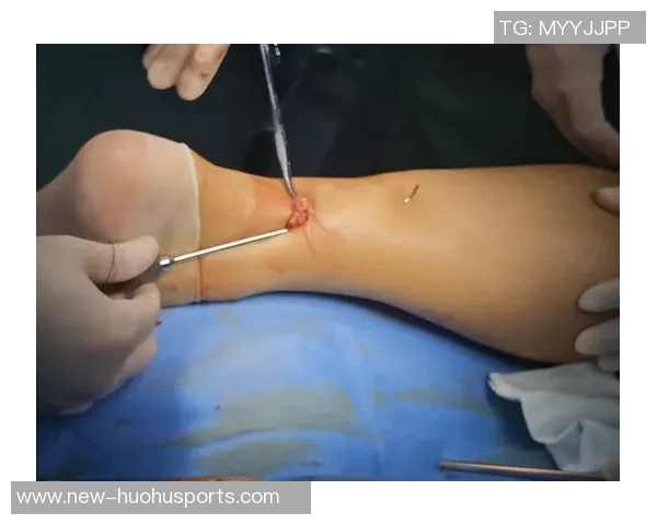 科瓦契奇本赛季仅出场两次将于明年三月重返赛场接受跟腱手术